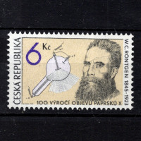 W. C. Röntgen a rentgenka